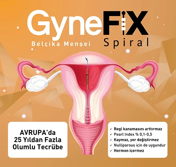 GyneFix Spiral