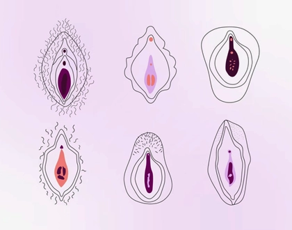 Kızlık Zarı Dikilince Eskisi Gibi Olur mu?